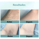 Depilador A Laser 900 Mil Pulsos Portátil Elimina Pelos Indolor Seguro e Eficaz