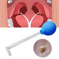 Tonsil Cure - Eliminador das famosas bolinhas fedidas - Inovação 2023