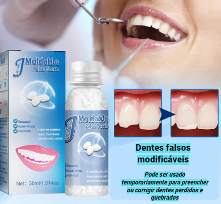 Solução dental para dentes perdidos